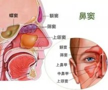 【全國愛鼻日】孩子出現(xiàn)這些癥狀，警惕鼻竇炎！